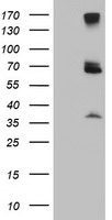 p58 / PSMD3 Antibody - HEK293T cells were transfected with the pCMV6-ENTRY control (Left lane) or pCMV6-ENTRY PSMD3 (Right lane) cDNA for 48 hrs and lysed. Equivalent amounts of cell lysates (5 ug per lane) were separated by SDS-PAGE and immunoblotted with anti-PSMD3.