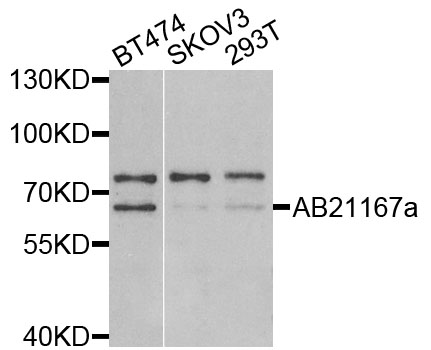p58 / PSMD3 Antibody - Western blot analysis of extracts of various cells.