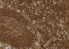 p58 / PSMD3 Antibody - 1:100 staining mouse spleen tissue by IHC-P. The sample was formaldehyde fixed and a heat mediated antigen retrieval step in citrate buffer was performed. The sample was then blocked and incubated with the antibody for 1.5 hours at 22°C. An HRP conjugated goat anti-rabbit antibody was used as the secondary.
