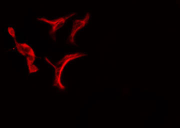 p58 / PSMD3 Antibody - Staining HeLa cells by IF/ICC. The samples were fixed with PFA and permeabilized in 0.1% Triton X-100, then blocked in 10% serum for 45 min at 25°C. The primary antibody was diluted at 1:200 and incubated with the sample for 1 hour at 37°C. An Alexa Fluor 594 conjugated goat anti-rabbit IgG (H+L) antibody, diluted at 1/600, was used as secondary antibody.