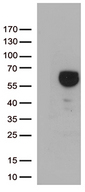 P5CDH / ALDH4A1 Antibody - HEK293T cells were transfected with the pCMV6-ENTRY control. (Left lane) or pCMV6-ENTRY ALDH4A1. (Right lane) cDNA for 48 hrs and lysed. Equivalent amounts of cell lysates. (5 ug per lane) were separated by SDS-PAGE and immunoblotted with anti-ALDH4A1. (1:500)