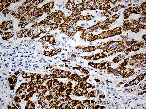 P5CDH / ALDH4A1 Antibody - Immunohistochemical staining of paraffin-embedded Human liver tissue within the normal limits using anti-ALDH4A1 mouse monoclonal antibody. (Heat-induced epitope retrieval by 1mM EDTA in 10mM Tris buffer. (pH8.5) at 120°C for 3 min. (1:500)