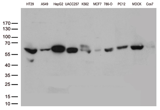 P5CDH / ALDH4A1 Antibody - Western blot analysis of extracts. (35ug) from 10 different cell lines by using anti-ALDH4A1 monoclonal antibody. (1:500)