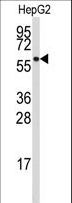 P5CDH / ALDH4A1 Antibody - Western blot of anti-ALDH4A1 Antibody in HepG2 cell line lysates (35 ug/lane). ALDH4A1(arrow) was detected using the purified antibody.