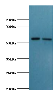 P5CDH / ALDH4A1 Antibody - Western blot. All lanes: Delta-1-pyrroline-5-carboxylate dehydrogenase, mitochondrial antibody at 13 ug/ml. Lane 1: K562 whole cell lysate. Lane 2: 293T whole cell lysate. Secondary antibody: Goat polyclonal to rabbit at 1:10000 dilution. Predicted band size: 62 kDa. Observed band size: 62 kDa.