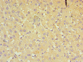 P5CDH / ALDH4A1 Antibody - Immunohistochemistry of paraffin-embedded human liver using antibody at 1:100 dilution.