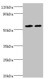 P5CDH / ALDH4A1 Antibody - Western blot All lanes: ALDH4A1 antibody at 13µg/ml Lane 1: K562 whole cell lysate Lane 2: 293T whole cell lysate Secondary Goat polyclonal to rabbit IgG at 1/10000 dilution Predicted band size: 62, 56, 57 kDa Observed band size: 62 kDa