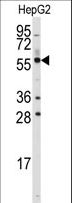 P5CDH / ALDH4A1 Antibody - Western blot of anti-ALDH4A1 Antibody in HepG2 cell line lysates (35 ug/lane). ALDH4A1(arrow) was detected using the purified antibody.
