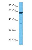P5CDH / ALDH4A1 Antibody - Western blot of ALDH4A1 Antibody with human Fetal Liver lysate.  This image was taken for the unconjugated form of this product. Other forms have not been tested.