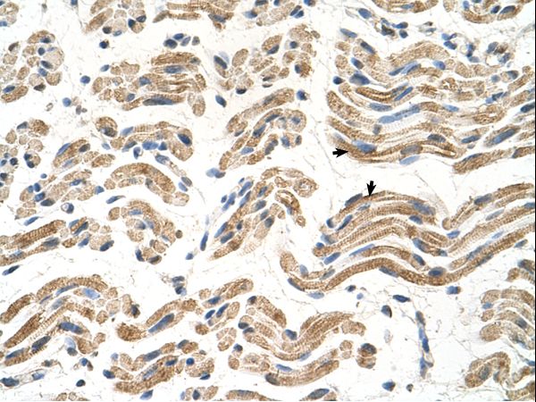 P5CDH / ALDH4A1 Antibody - ALDH4A1 antibody ALDH4A1(aldehyde dehydrogenase 4 family, member A1) Antibody was used in IHC to stain formalin-fixed, paraffin-embedded human muscle.  This image was taken for the unconjugated form of this product. Other forms have not been tested.