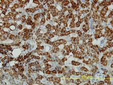 P5CDH / ALDH4A1 Antibody - Immunoperoxidase of monoclonal antibody to ALDH4A1 on formalin-fixed paraffin-embedded human liver tissue.[antibody concentration 5 ug/ml].