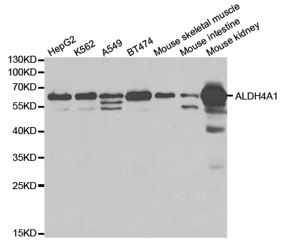 P5CDH / ALDH4A1 Antibody - Western blot analysis of extracts of various cell lines.