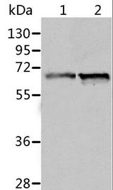 P5CDH / ALDH4A1 Antibody - Western blot analysis of Human fetal liver and liver cancer tissue, using ALDH4A1 Polyclonal Antibody at dilution of 1:450.