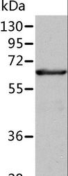 P5CDH / ALDH4A1 Antibody - Western blot analysis of Human fetal liver tissue, using ALDH4A1 Polyclonal Antibody at dilution of 1:350.