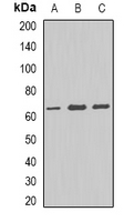 P5CDH / ALDH4A1 Antibody - Western blot analysis of ALDH4A1 expression in K562 (A); A549 (B); mouse kidney (C) whole cell lysates.