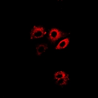 P5CDH / ALDH4A1 Antibody - Immunofluorescent analysis of ALDH4A1 staining in A549 cells. Formalin-fixed cells were permeabilized with 0.1% Triton X-100 in TBS for 5-10 minutes and blocked with 3% BSA-PBS for 30 minutes at room temperature. Cells were probed with the primary antibody in 3% BSA-PBS and incubated overnight at 4 deg C in a humidified chamber. Cells were washed with PBST and incubated with a DyLight 594-conjugated secondary antibody (red) in PBS at room temperature in the dark.