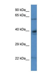 P5CDH / ALDH4A1 Antibody - ALDH4A1 antibody Western blot of Rat Kidney lysate. Antibody concentration 1 ug/ml. This image was taken for the unconjugated form of this product. Other forms have not been tested.