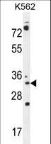 P5CR2 / PYCR2 Antibody - PYCR2 Antibody western blot of K562 cell line lysates (35 ug/lane). The PYCR2 antibody detected the PYCR2 protein (arrow).