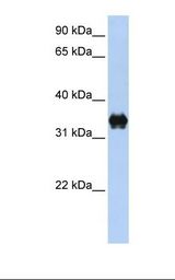 P5CR2 / PYCR2 Antibody - 293T cell lysate. Antibody concentration: 1.0 ug/ml. Gel concentration: 12%.  This image was taken for the unconjugated form of this product. Other forms have not been tested.