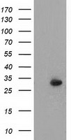 P5CR2 / PYCR2 Antibody - HEK293T cells were transfected with the pCMV6-ENTRY control (Left lane) or pCMV6-ENTRY PYCR2 (Right lane) cDNA for 48 hrs and lysed. Equivalent amounts of cell lysates (5 ug per lane) were separated by SDS-PAGE and immunoblotted with anti-PYCR2.