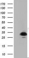 P5CR2 / PYCR2 Antibody - HEK293T cells were transfected with the pCMV6-ENTRY control (Left lane) or pCMV6-ENTRY PYCR2 (Right lane) cDNA for 48 hrs and lysed. Equivalent amounts of cell lysates (5 ug per lane) were separated by SDS-PAGE and immunoblotted with anti-PYCR2.