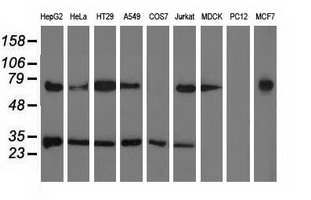 P5CR2 / PYCR2 Antibody - Western blot of extracts (35 ug) from 9 different cell lines by using anti-PYCR2 monoclonal antibody.