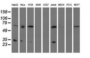 P5CR2 / PYCR2 Antibody - Western blot analysis of extracts (35ug) from 9 different cell lines by using anti-PYCR2 monoclonal antibody.