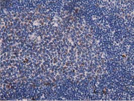 P5CR2 / PYCR2 Antibody - IHC of paraffin-embedded Human lymph node tissue using anti-PYCR2 mouse monoclonal antibody.