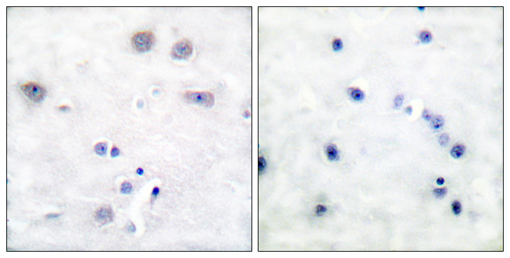 p66 / SHC Antibody - Immunohistochemistry analysis of paraffin-embedded human brain tissue, using Shc Antibody. The picture on the right is blocked with the synthesized peptide.