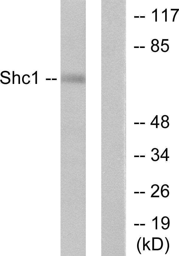 p66 / SHC Antibody - Western blot analysis of lysates from HeLa cells, treated with Calyculin A 50nM 15', using Shc Antibody. The lane on the right is blocked with the synthesized peptide.