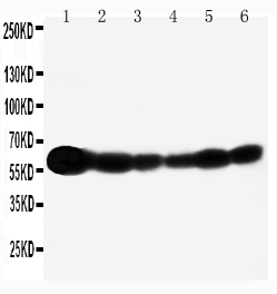 p66 / SHC Antibody - WB of p66 / SHC antibody. Lane 1: Rat Brain Tissue Lysate. Lane 2: A549 Cell Lysate. Lane 3: A431 Cell Lysate. Lane 4: 293T Cell Lysate. Lane 5: HELA Cell Lysate. Lane 6: JURKAT Cell Lysate..