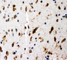 p66 / SHC Antibody - p66 / SHC antibody. IHC(P): Rat Brain Tissue.