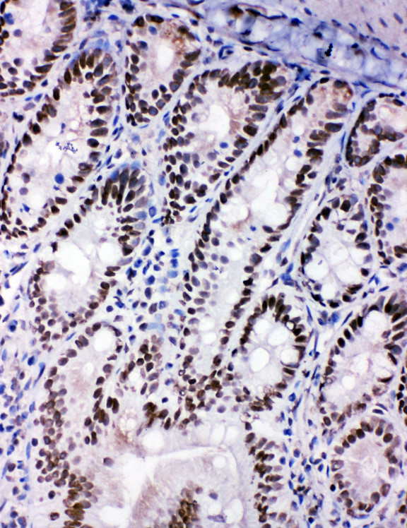 p66 / SHC Antibody - p66 / SHC antibody. IHC(F): Rat Intestine Tissue.