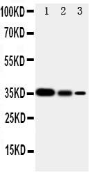 p66 / SHC Antibody - Anti-SHC antibody, Western blottingRecombinant Protein Detection Source: E. coli derived -recombinant human SHC1, 35. 0KD(162aa tag+D424-P578)Lane 1: Recombinant Human SHC1 Proteins 10ng Lane 2: Recombinant Human SHC1 Proteins 5ng Lane 3: Recombinant Human SHC1 Proteins 2. 5ng