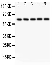 p66 / SHC Antibody - SHC1 antibody Western blot. All lanes: Anti SHC1 at 0.5 ug/ml. Lane 1: Rat Thymus Tissue Lysate at 50 ug. Lane 2: Mouse Testis Tissue Lysate at 50 ug. Lane 3: JURKAT Whole Cell Lysate at 40 ug. Lane 4: K562 Whole Cell Lysate at 40 ug. Lane 5: HELA Whole Cell Lysate at 40 ug. Predicted band size: 63 kD. Observed band size: 63 kD.
