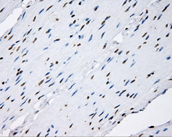 p66 / SHC Antibody - IHC of paraffin-embedded colon tissue using anti-SHC1 mouse monoclonal antibody. (Dilution 1:50).