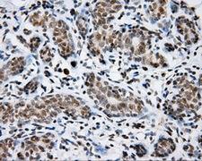 p66 / SHC Antibody - IHC of paraffin-embedded breast tissue using anti-SHC1 mouse monoclonal antibody. (Dilution 1:50).