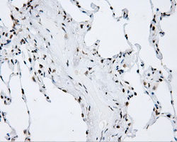 p66 / SHC Antibody - IHC of paraffin-embedded lung tissue using anti-SHC1 mouse monoclonal antibody. (Dilution 1:50).