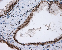 p66 / SHC Antibody - IHC of paraffin-embedded prostate tissue using anti-SHC1 mouse monoclonal antibody. (Dilution 1:50).