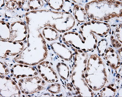 p66 / SHC Antibody - IHC of paraffin-embedded Kidney tissue using anti-SHC1 mouse monoclonal antibody. (Dilution 1:50).