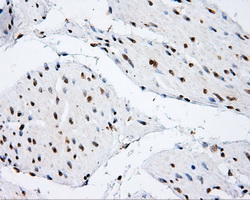 p66 / SHC Antibody - IHC of paraffin-embedded bladder tissue using anti-SHC1 mouse monoclonal antibody. (Dilution 1:50).