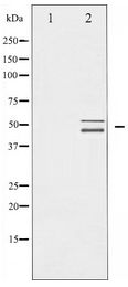 p66 / SHC Antibody - Western blot of Shc expression in Calyculin A treated HeLa whole cell lysates,The lane on the left is treated with the antigen-specific peptide.