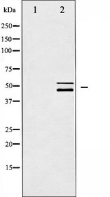 p66 / SHC Antibody - Western blot analysis of Shc expression in CalyculinA treated HeLa whole cells lysates. The lane on the left is treated with the antigen-specific peptide.
