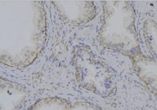 p66 / SHC Antibody - 1:100 staining mouse testis tissue by IHC-P. The sample was formaldehyde fixed and a heat mediated antigen retrieval step in citrate buffer was performed. The sample was then blocked and incubated with the antibody for 1.5 hours at 22°C. An HRP conjugated goat anti-rabbit antibody was used as the secondary.