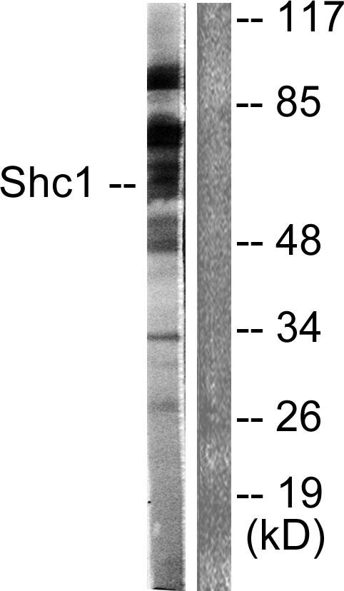 p66 / SHC Antibody - Western blot analysis of extracts from Hela cells treated with Calyculin A (50nM, 15min), using Shc (Ab-349) antibody.