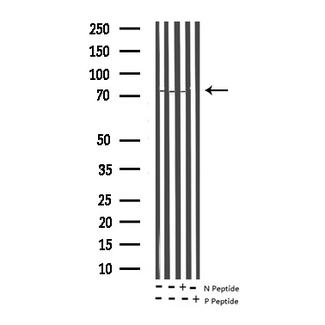 p66 / SHC Antibody - Western blot analysis of Phospho-Shc (Tyr349) expression in various lysates