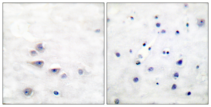 p66 / SHC Antibody - Immunohistochemistry analysis of paraffin-embedded human brain, using Shc (Phospho-Tyr427) Antibody. The picture on the right is blocked with the phospho peptide.