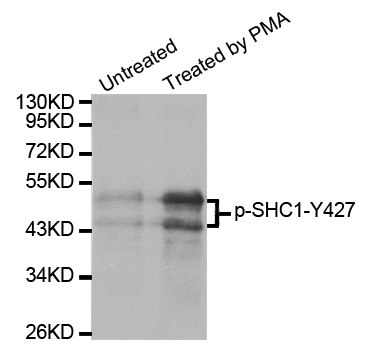 p66 / SHC Antibody - Western blot analysis of extracts from 293 cells.