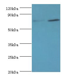 p84 / THOC1 Antibody - Western blot. All lanes: THOC1 antibody at 3 ug/ml. Lane 1: HepG2 whole cell lysate. Lane 2: 293T whole cell lysate. Secondary antibody: Goat polyclonal to rabbit at 1:10000 dilution. Predicted band size: 76 kDa. Observed band size: 76 kDa Immunohistochemistry.