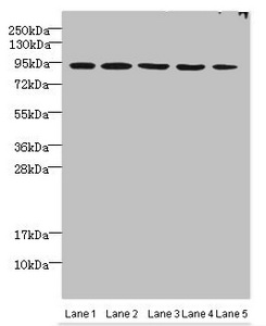p84 / THOC1 Antibody - Western blot All lanes: THOC1 antibody at 3µg/ml Lane 1: Jurkats whole cell lysate Lane 2: 293T whole cell lysate Lane 3: HepG2 whole cell lysate Lane 4: A549 whole cell lysate Lane 5: Mouse kidney tissue Secondary Goat polyclonal to rabbit IgG at 1/10000 dilution Predicted band size: 76, 44 kDa Observed band size: 76 kDa